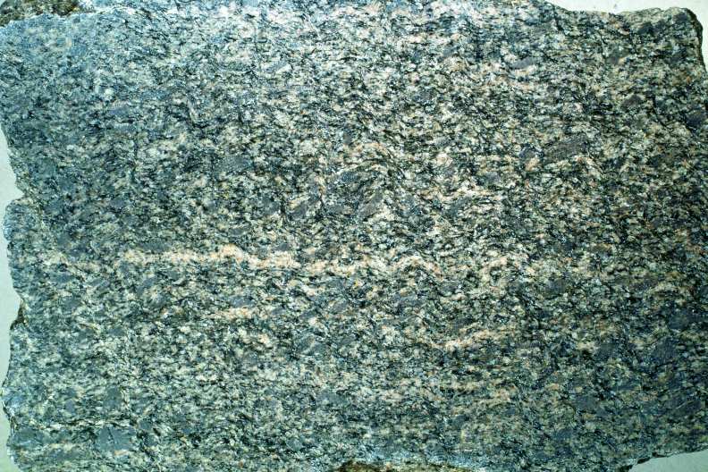 Staurolith-Granat-Plagioklas-Gneis